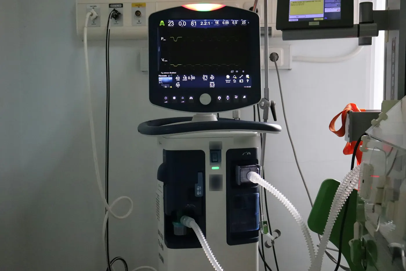 ICU ventilator with its screen showing pressure and flow waveforms and breathing circuit attached